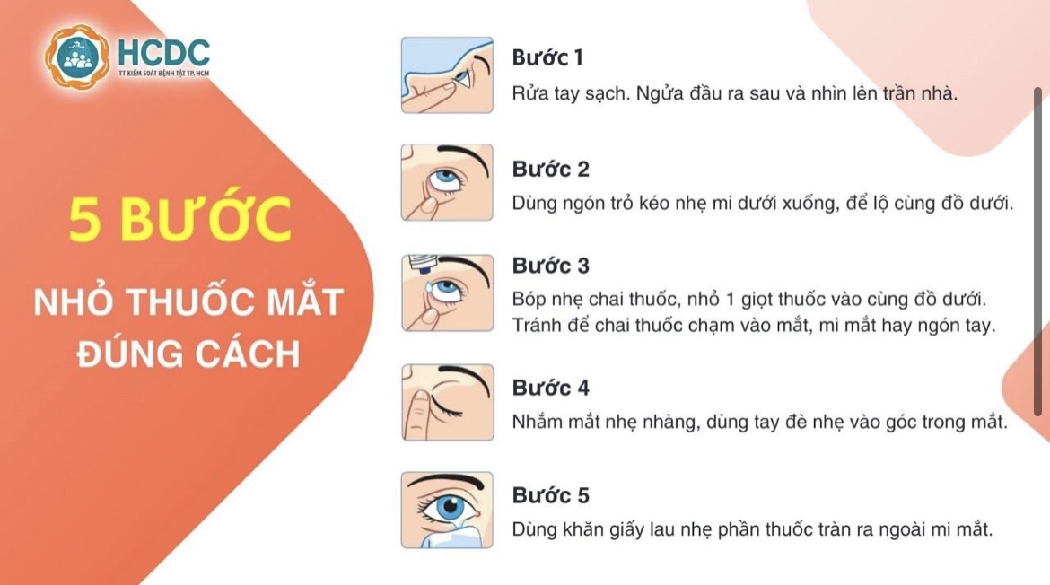 Đau mắt đỏ: Những điều cần lưu ý khi sử dụng thuốc nhỏ mắt